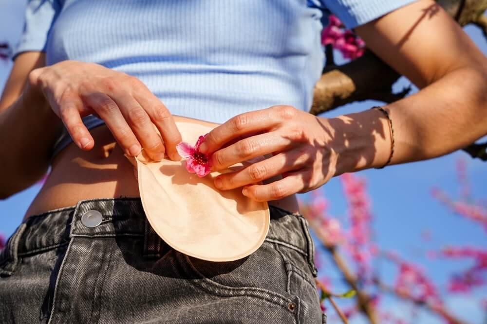 Stoma Care and Management Certification