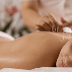 Medical Acupuncture Certification