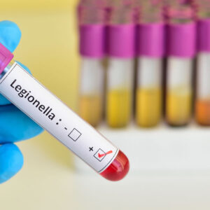Legionnaires’ Disease Awareness Certification